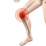 Comment évolue l’arthrose du genou ?