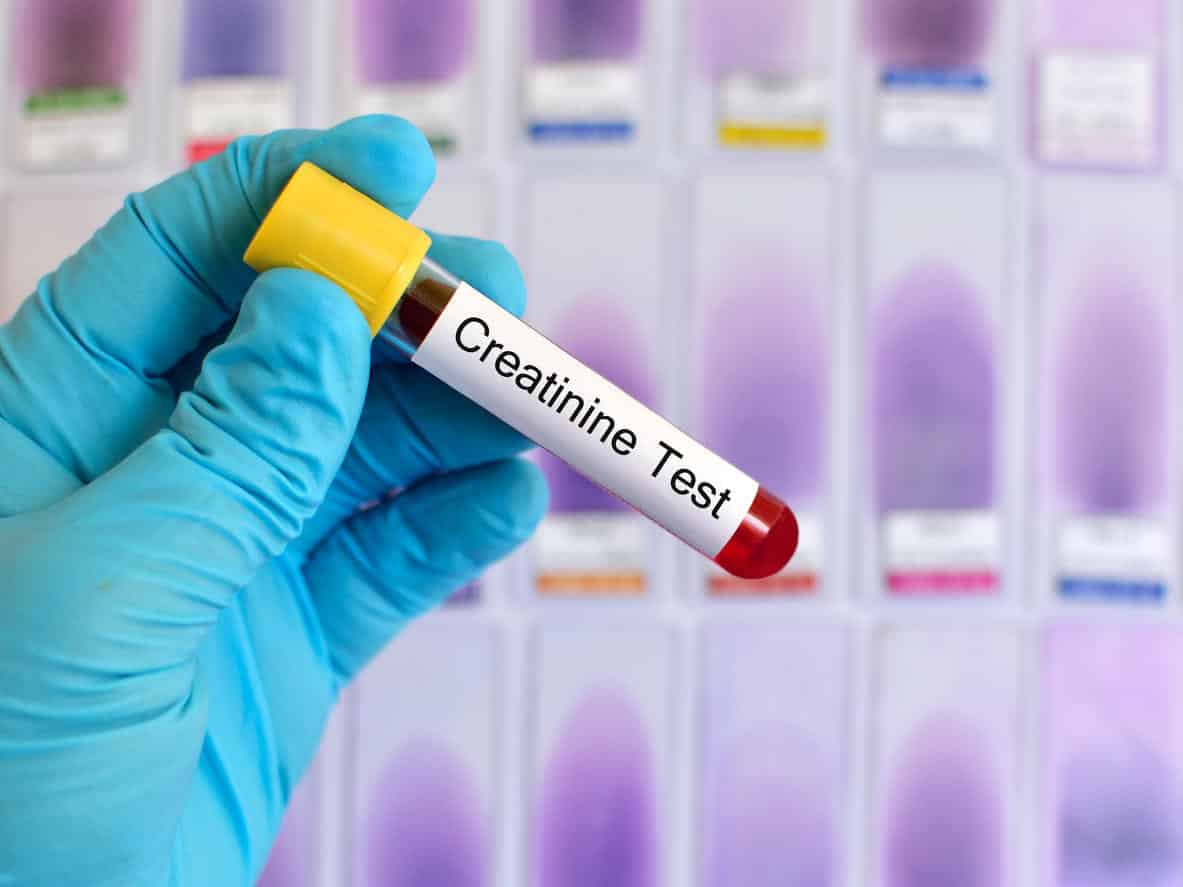 Créatinine test